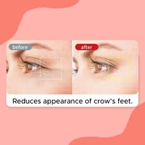 Skin Spectra before after 3